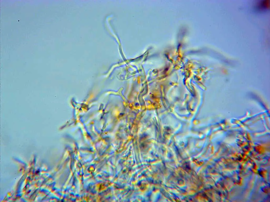 Microscopía de Fabisporus sanguineus - 36 - Sistema trimitico